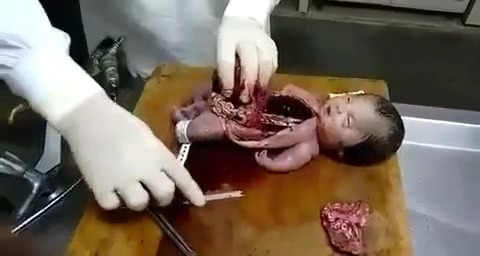 Плакат для 暗网重口，谨慎观看婴儿解剖