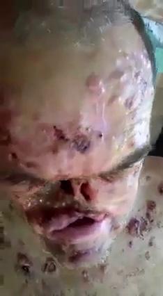 寄生虫快要把他吃光了 的封面