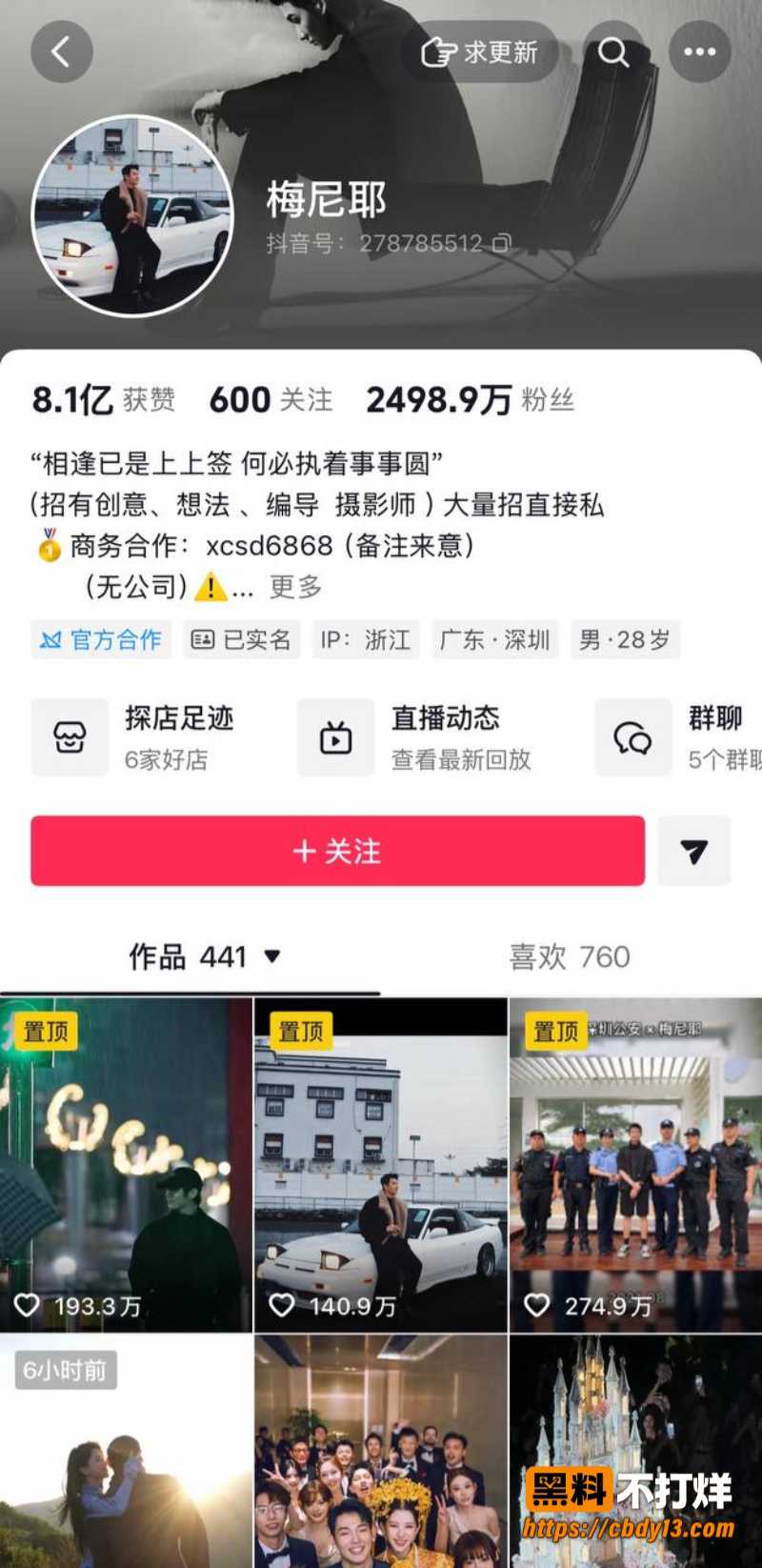 梅尼耶4