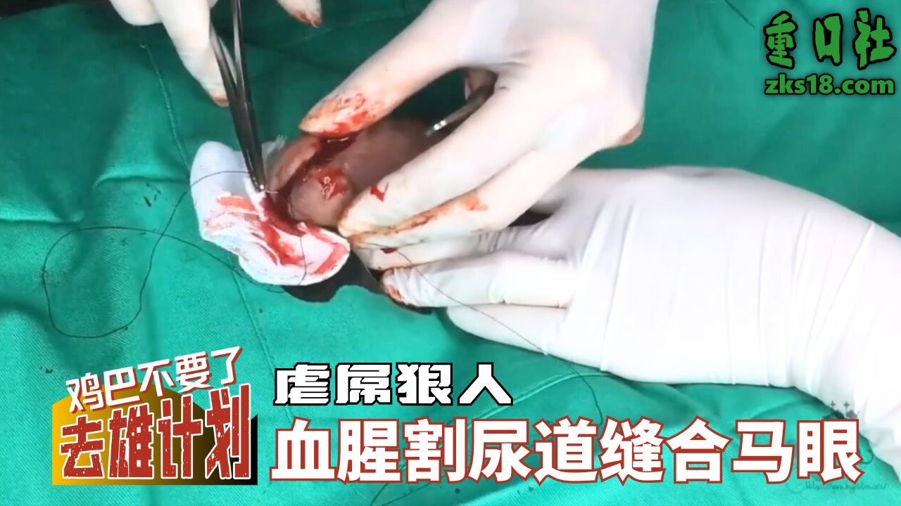 Poster for 去雄计划-虐屌狠人血腥割尿道缝合马眼